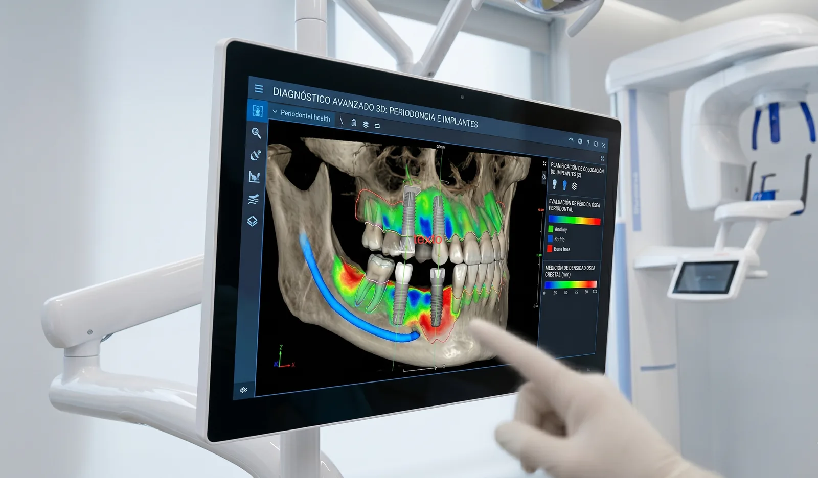 Pantalla de diagnóstico avanzado 3D mostrando planificación de implantes y evaluación periodontal en Clínica Arca